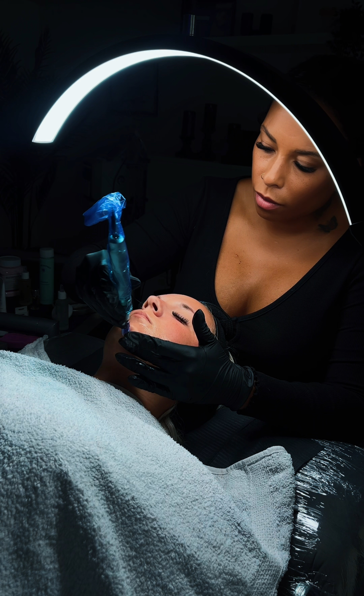 Microneedling - Lewis Lashes Cosmetic Lounge